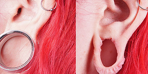 stretched-lobes